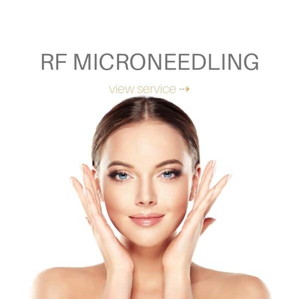 medical-rf-microneedling