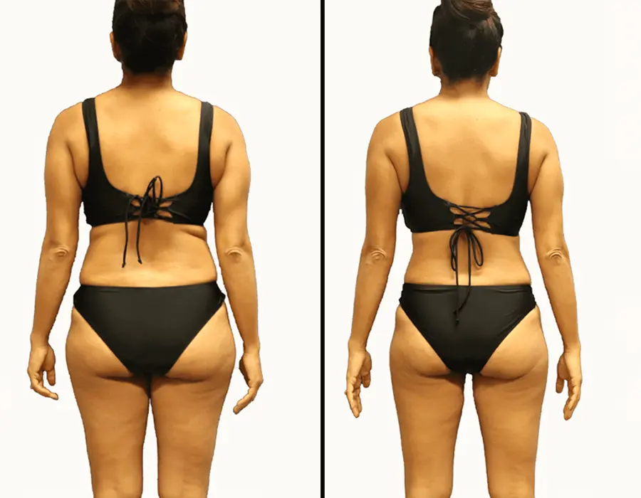 new-beauty-wellness-weight-loss-before-and-after-3