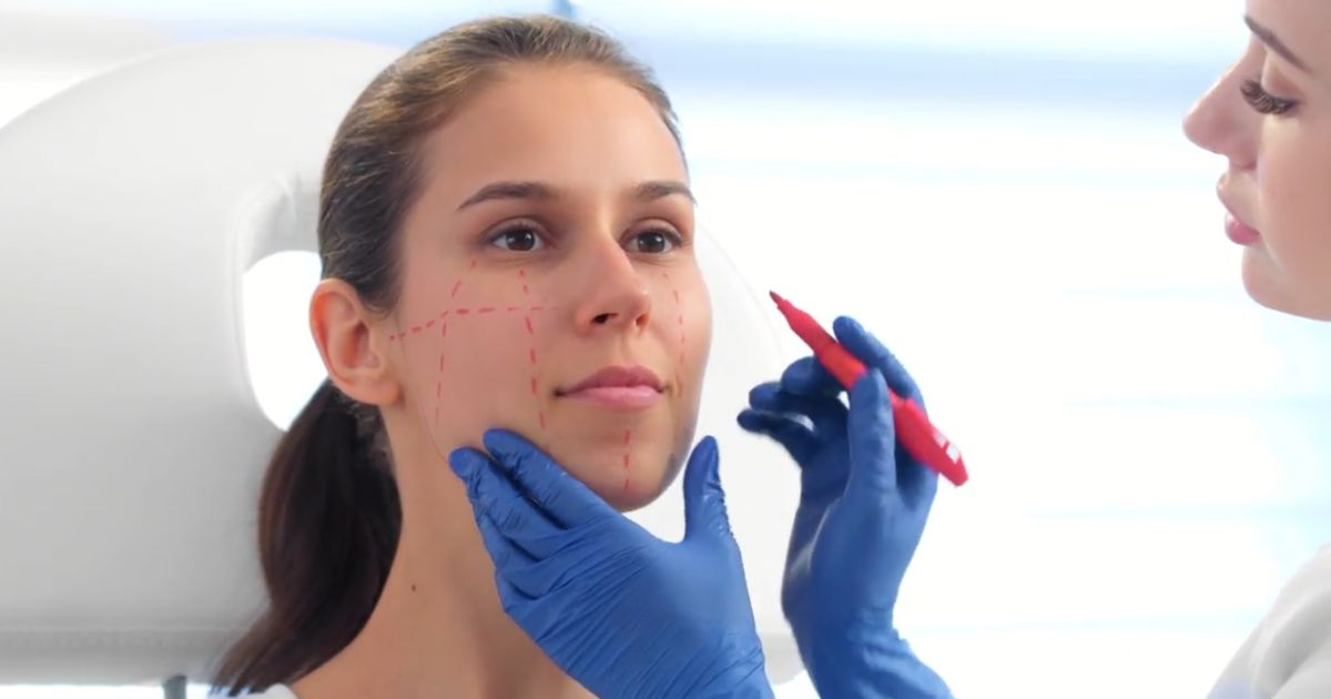 A provider marks a patient's cheeks and jawline during a facial assessment for dermal filler treatment.